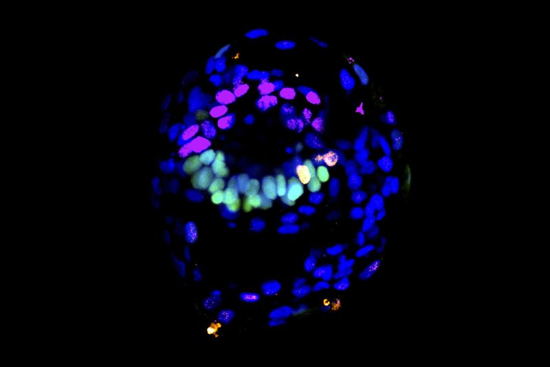 Модели эмбрионов, выращенных в лабораторных условиях, становятся все более реалистичными. Ученые все больше беспокоятся 83 Lab-grown embryo models are getting more realistic. Scientists are getting more concerned